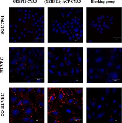 Near-infrared-dye labeled tumor vascular-targeted dimer GEBP11 peptide for image-guided surgery in gastric cancer
